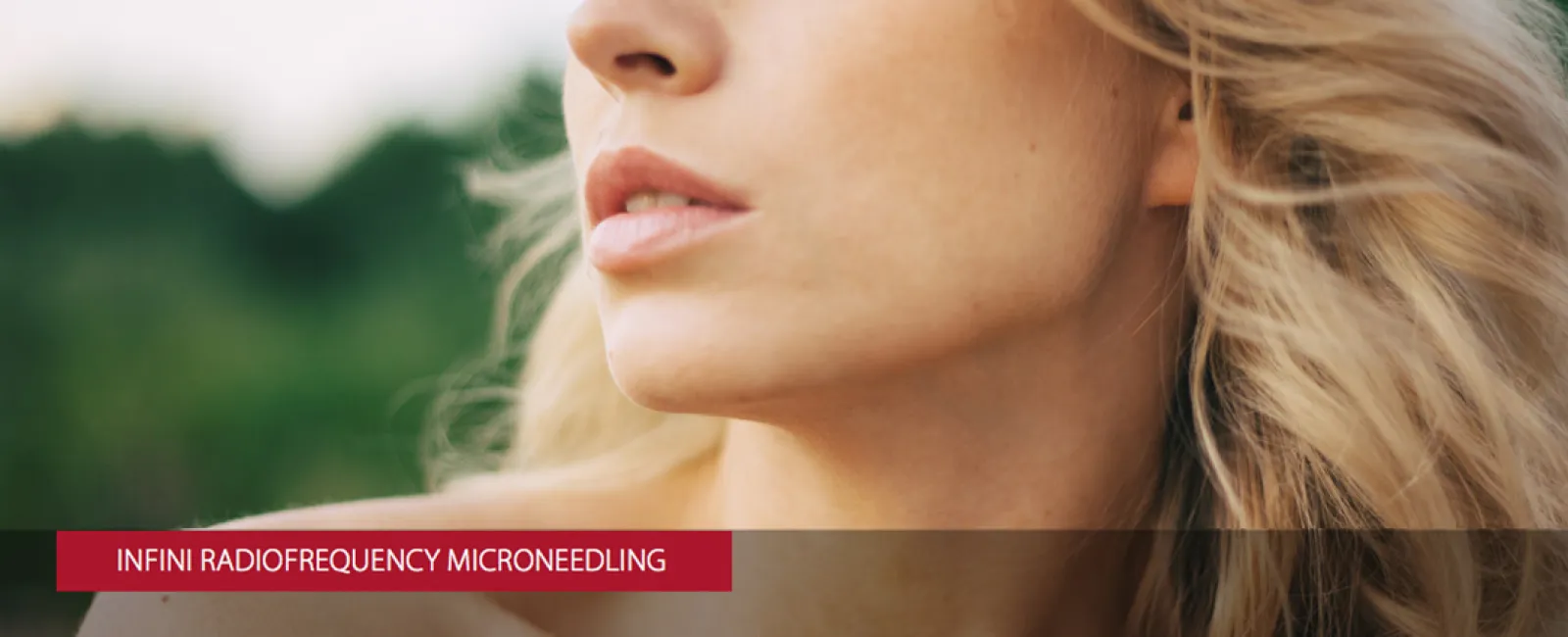 INFINI Radiofrequency Microneedling