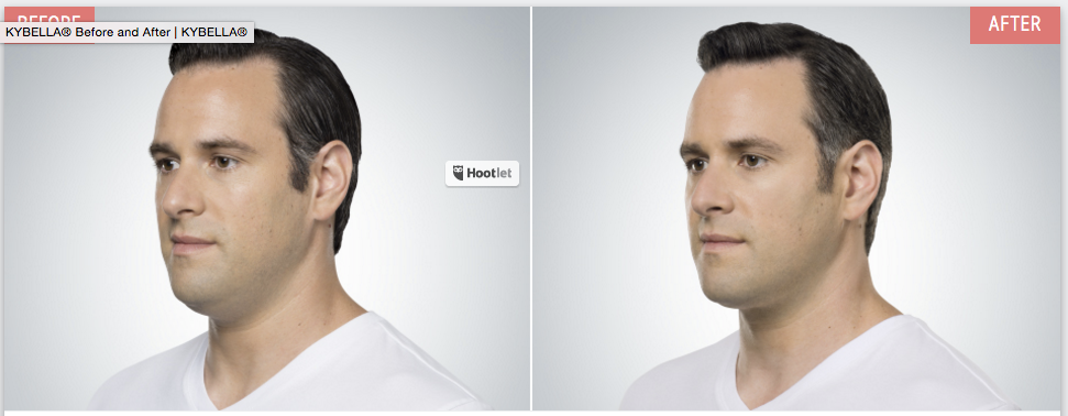 Screen-Shot-2016-09-23