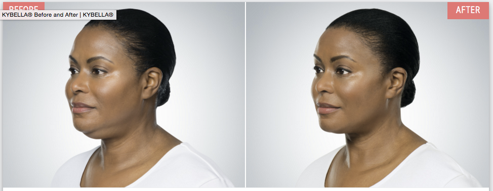 Screen-Shot-2016-09-23