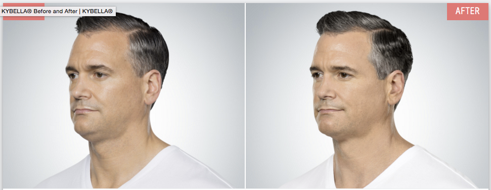 Screen-Shot-2016-09-23