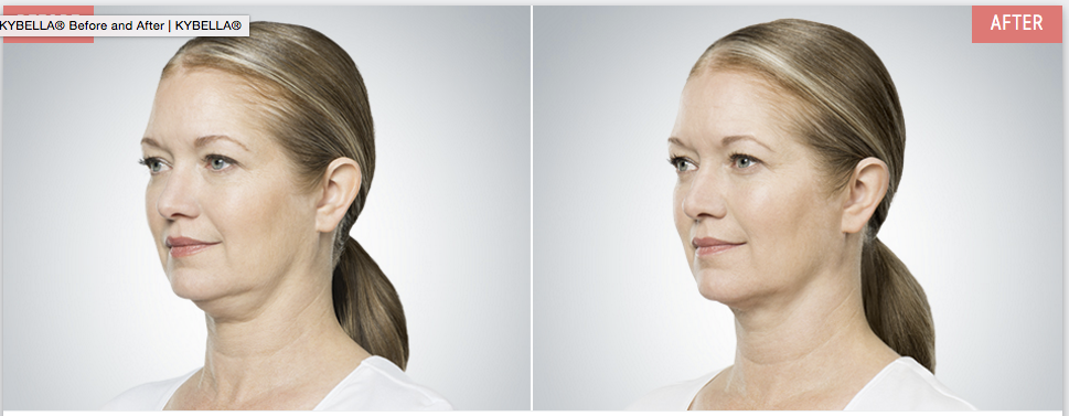 Screen-Shot-2016-09-23