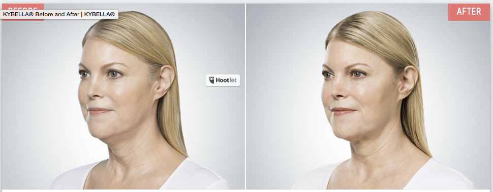 Screen-Shot-2016-09-23