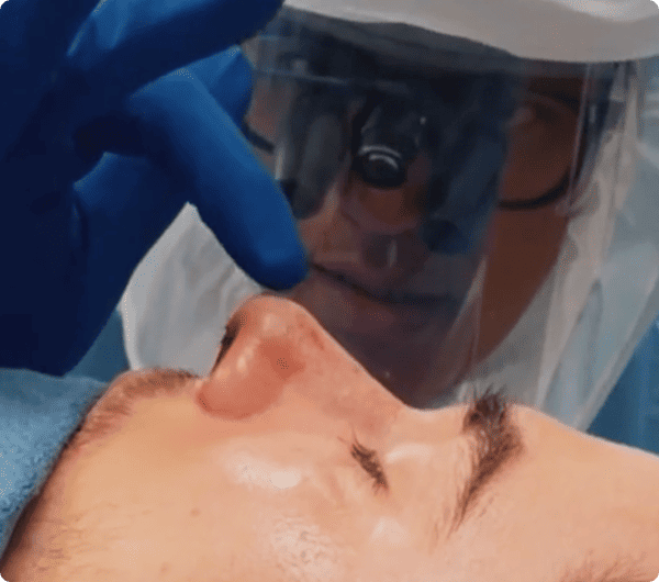 After surgery image - Facial Aesthetics Surgery