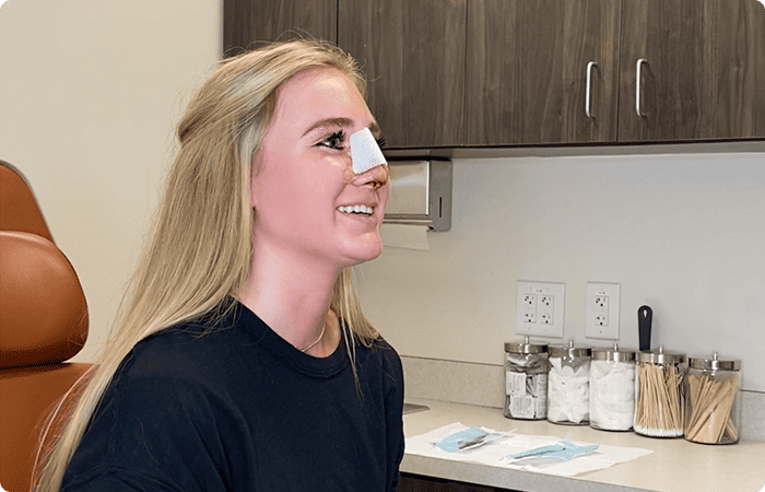 First few days Rhinoplasty - Facial Aesthetics Surgery