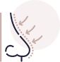 Revision Rhinoplasty icon