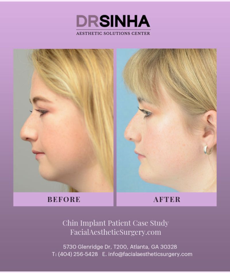 facialaestheticsurgerynew_972094869