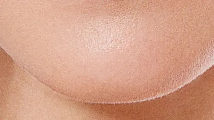 Chin Image
